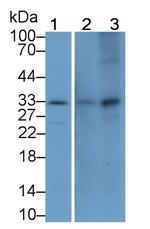 MMP7 Monoclonal Antibody (J8)
