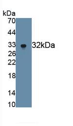 MMP7 Antibody in Western Blot (WB)