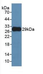 MMP25 Antibody in Western Blot (WB)