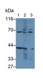 Mesothelin Monoclonal Antibody (C6)