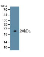 LTBR Monoclonal Antibody (C1)