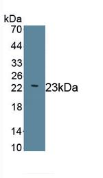 Laminin gamma-2 Antibody in Western Blot (WB)