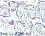 KISS1 Monoclonal Antibody (C1)