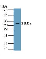 ITGB6 Monoclonal Antibody (C5)