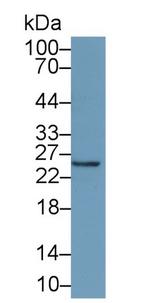 Interferon alpha-21 Monoclonal Antibody (d4)