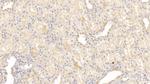 INHBB Monoclonal Antibody (C11)