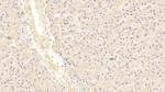 INHBB Antibody in Immunohistochemistry (Paraffin) (IHC (P))