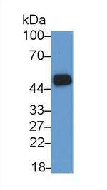 INHBB Antibody in Western Blot (WB)