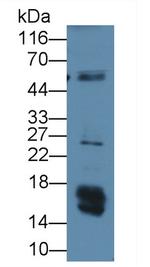 Leptin Monoclonal Antibody (C5)