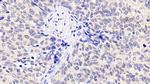 INHA Antibody in Immunohistochemistry (Paraffin) (IHC (P))