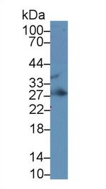 IGFBP4 Monoclonal Antibody (A4)