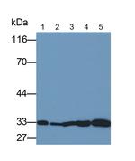 NGF Monoclonal Antibody (C2)
