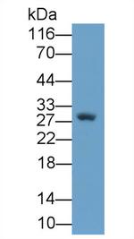 NGF Antibody in Western Blot (WB)