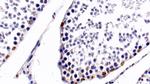 HDAC1 Antibody in Immunohistochemistry (Paraffin) (IHC (P))