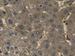 Haptoglobin Antibody in Immunohistochemistry (Paraffin) (IHC (P))