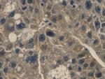 Haptoglobin Monoclonal Antibody (C12)