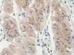 GREM1 Monoclonal Antibody (C1)