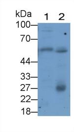 GLUT1 Monoclonal Antibody (C5)