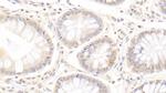 SCNN1G Antibody in Immunohistochemistry (Paraffin) (IHC (P))