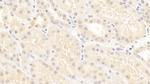 SCNN1G Monoclonal Antibody (C1)