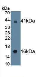 SCNN1G Antibody in Western Blot (WB)
