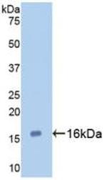 Galectin 7 Monoclonal Antibody (C2)