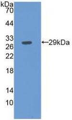Fibulin 3 Monoclonal Antibody (C5)