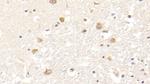 FIBB Antibody in Immunohistochemistry (Paraffin) (IHC (P))