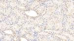 FIBB Antibody in Immunohistochemistry (Paraffin) (IHC (P))