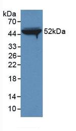 FIBB Antibody in Western Blot (WB)