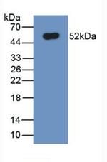 Ferroportin Monoclonal Antibody (C2)