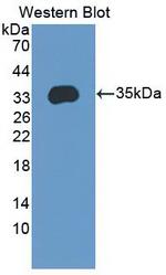ENPP2 Antibody in Western Blot (WB)