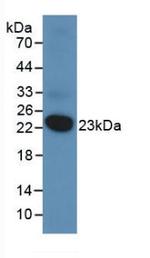 DUSP3 Monoclonal Antibody (2#)