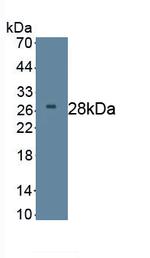 DKK2 Monoclonal Antibody (C1)