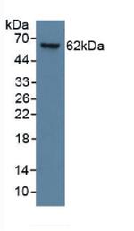 KRT9 Antibody in Western Blot (WB)