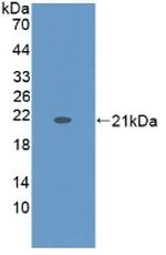 KRT9 Antibody in Western Blot (WB)