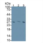 Factor D Antibody in Western Blot (WB)