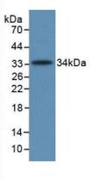 Complement C5a Antibody in Western Blot (WB)