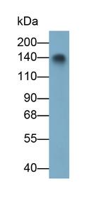 Procollagen I N-Peptide Monoclonal Antibody (H20)
