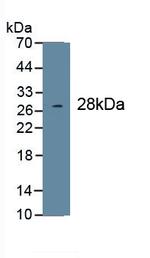 COL1A1 Monoclonal Antibody (C3)