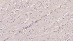 Chemerin Antibody in Immunohistochemistry (Paraffin) (IHC (P))