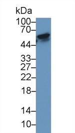 RANK (CD265) Antibody in Western Blot (WB)