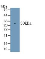 CD226 (DNAM-1) Monoclonal Antibody (C1)