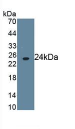 CD16b (FCGR3B) Monoclonal Antibody (C1)