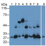 Cathepsin K Antibody in Western Blot (WB)
