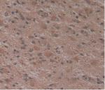 Atrophin 1 Monoclonal Antibody (C1)