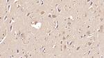 ASPH Antibody in Immunohistochemistry (Paraffin) (IHC (P))