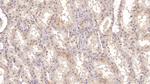 ASPH Antibody in Immunohistochemistry (Paraffin) (IHC (P))
