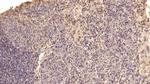 ARMET Monoclonal Antibody (C2)