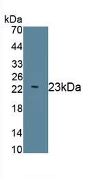 ARMET Antibody in Western Blot (WB)